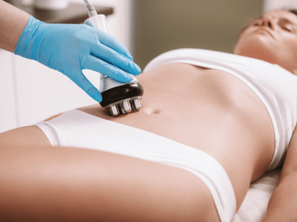 woman having a RT skin treatment for the belly