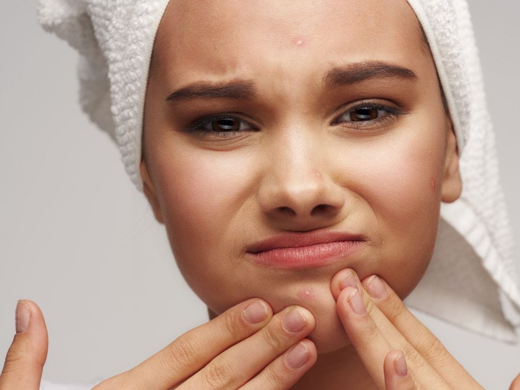 woman squeezing white pimples