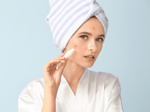 woman with a towel on her head treats pimples with a cream